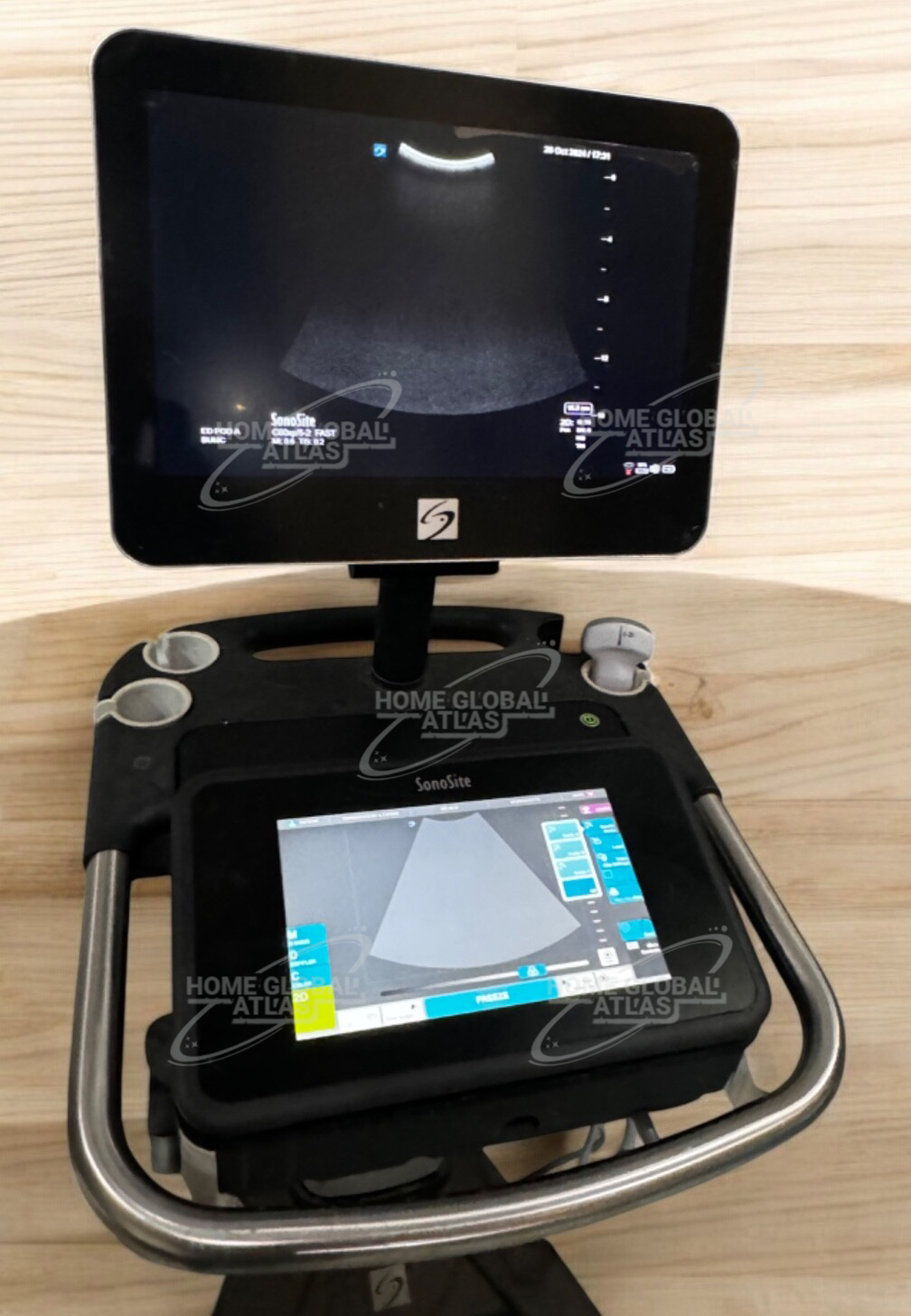 SonoSite X Porte